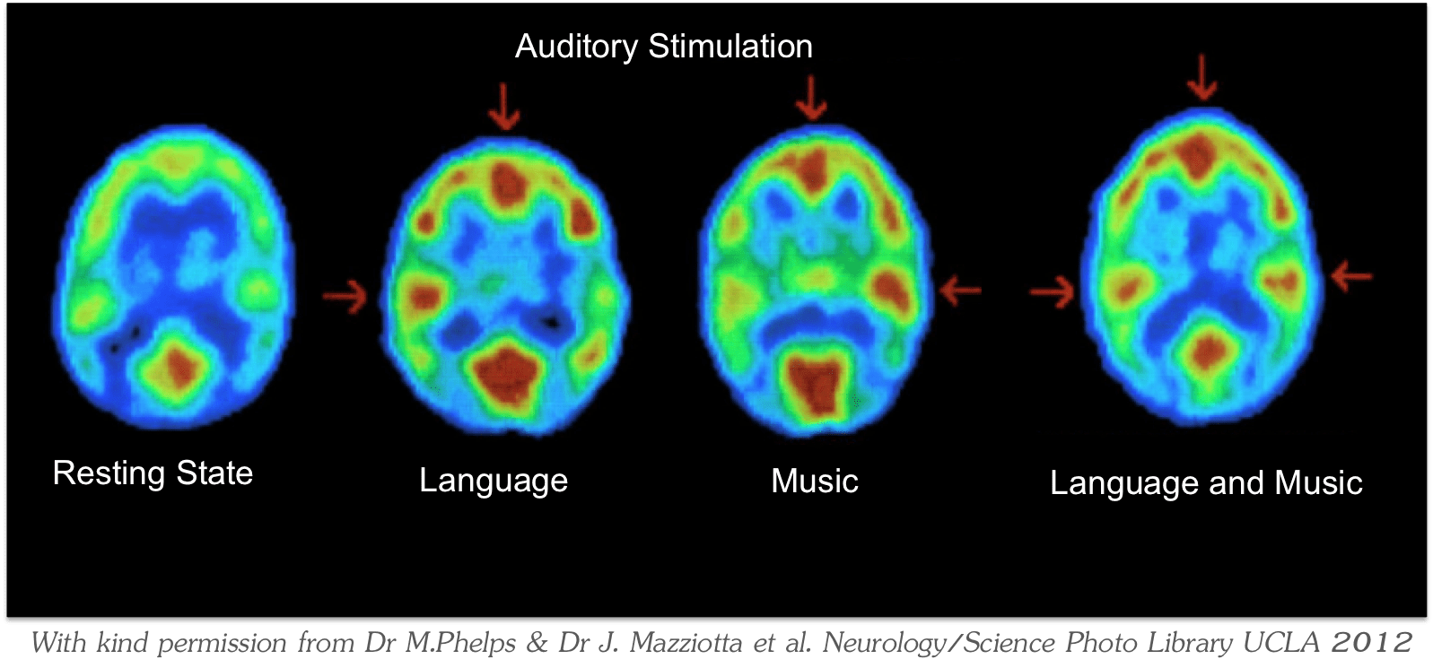 Listening in the brain MESHGuides
